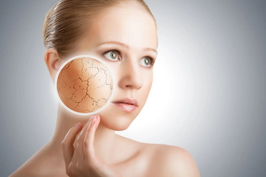 5 Reasons Why Your Skin May Be Dry Repêchage®