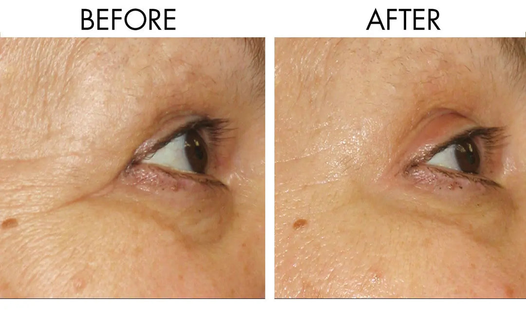 How to Reduce Fine Lines and Wrinkles | Anti-Aging Beauty Tip Repêchage®