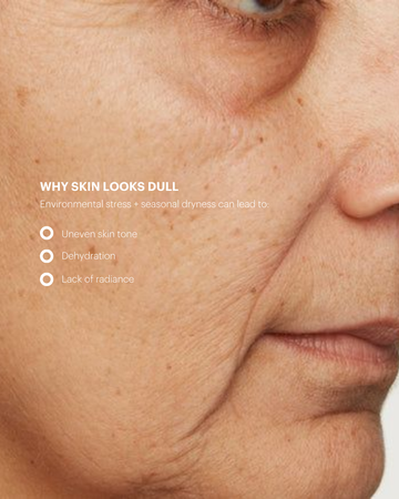 Biolight® Brightening Overnight Cream - Skin Brightening Moisturizer Biolight