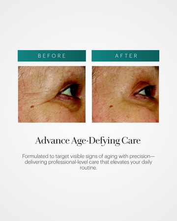 Vita Cura® Opti-Lift® Serum Vita Cura