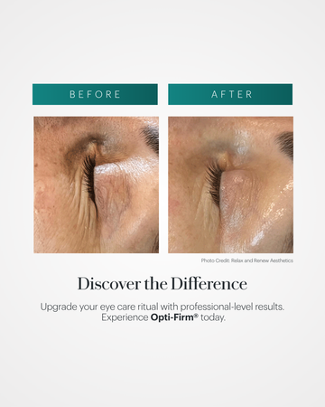 Opti-Firm® Eye Contour Cream Hydra Blue