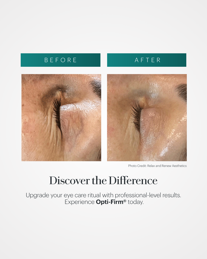 Opti-Firm® Eye Contour Cream Hydra Blue